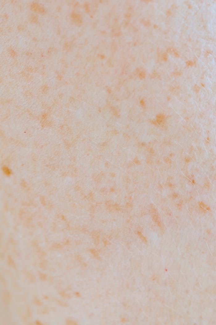 An extreme close-up of human skin showing freckles and texture, ideal for dermatology studies.